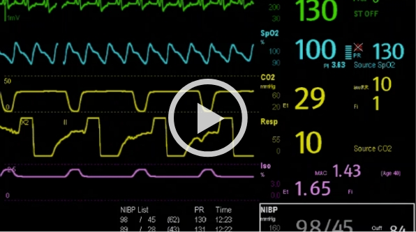 uMEC12Vet取扱い動画